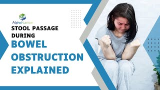 Stool Passage During Bowel Obstruction Explained