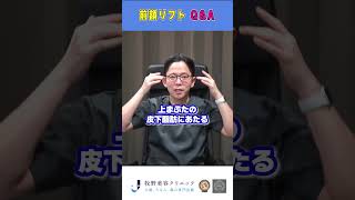 【Q\u0026A前額リフト】