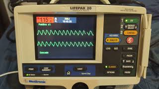 Physio-Control LIFEPAK 20/20e Alarms