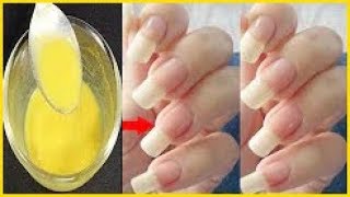 നഖം വളർത്താം എളുപ്പത്തിൽ  || Long \u0026 Strong Nails Fast At Home | Super fast Nails Growth Tips