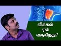 விக்கல் ஏன் வருகிறது ? அறிவியல் சார்ந்த தகவல் | Why Do We Get Hiccups? | தமிழ் அகாடமி