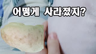 그 많았던 강아지 반점이 사라졌어요!