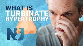 What Is Turbinate Hypertrophy | We Nose Noses