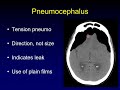 Complications of Skull Base Surgery
