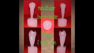 Mandibular second Premolar|| Right|| Carving|| 2 cusp type