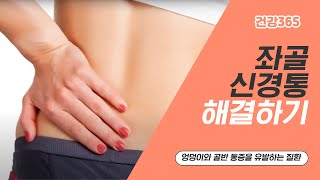 좌골 신경통 해결하기 [TBC클리닉건강365] [TBC-띠비띠]