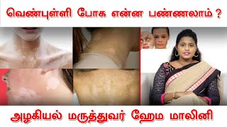 வெண்புள்ளி போக என்ன பண்ணலாம் ? | மருத்துவர் ஹேமமாலினி | Doctor Hema Malini