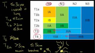 Lung Cancer Staging, 7th edition AJCC