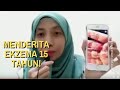 TESTIMONI SHIRUTO - Gastrik & Ekzema Selama 15 Tahun