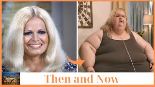 20 People Who Had Extreme Plastic Surgery | Then and now 2025