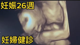 妊娠26週妊婦健診と体調不良について‼︎#妊婦#vlog