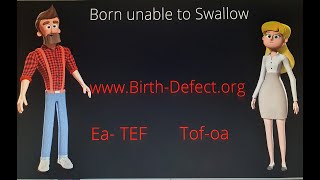 Born unable to Swallow. Ea-Tef.  Tof-oa.