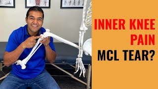 Is Your Painful Inner Knee Problem Really An MCL Tear? [Symptoms & Diagnosis]