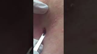 You’re a Crusty Guy! DPOW Extraction #shorts