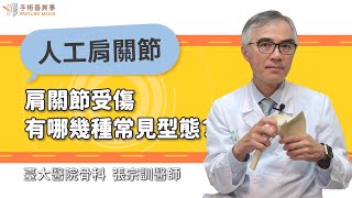 【肩關節受傷有哪幾種常見型態？】張宗訓醫師／臺大醫院骨科｜手術善其事