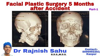 Face Surgery ||Cosmetic surgery in india ||Dr Rajnish Sahu || Part- 1