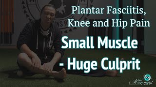 Plantar Fasciitis - The biggest culprit | Movement Advice |