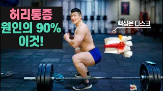 허리통증! 다치기 싫으면 꼭 보세요! 스쿼트 데드 부상 원인! [허리 디스크]