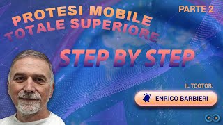 Protesi mobile totale superiore step by step