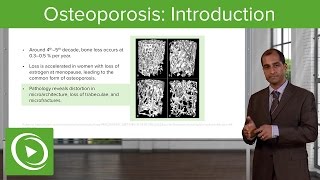 Osteoporosis: Introduction & Causes – Endocrine Pathology | Lecturio
