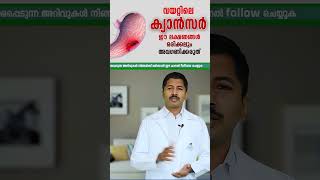 വയറ്റിലെ കാൻസർ ഈ 4 ലക്ഷണങ്ങൾ ഒരിക്കലും അവഗണിക്കരുത് Part 1 #stomach  #cancer