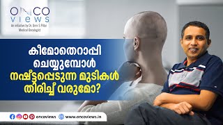 കീമോതെറാപ്പി ചെയ്യുമ്പോൾ കൊഴിഞ്ഞ് പോവുന്ന മുടികൾ തിരിച്ച് വരുമോ?