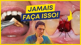 9 coisas que você JAMAIS deve fazer após EXTRAIR um dente.