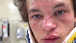 MTB Head Injury at Redbull Joyride, Recovery | Brayden Barrett-Hay: reGAINING PSYCHE, Ep. 1