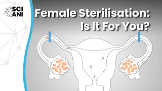 Female sterilisation: Is it for you?
