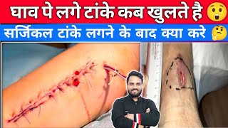 सर्जिकल टांके ( Stitches) कब,कितने दिन में खुलते हैं? | घर में देखभाल कैसे करें | कैसे जल्दी सूखेगा