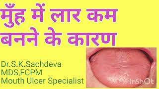 मुँह में लार/थूक का नहीं बनना। #drymouth #sjogren #burningmouth #मुँहकेछाले #tmtclinicsirsa