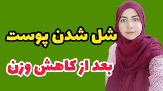 با افتادگی پوست بعد از کاهش وزن چکار کنیم ؟ شل شدن پوست بعد از رژیم لاغری