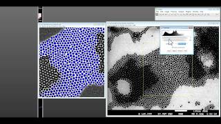 How to use ImageJ for nanoparticle size distribution analysis