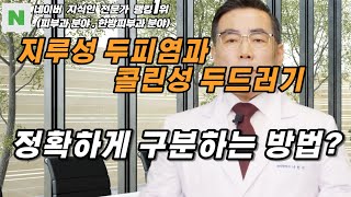 지루성두피염과 콜린성 두드러기의 구분 방법과 차이점은?