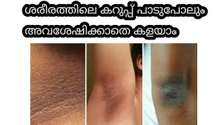 കഴുത്തിലെ കക്ഷത്തിലെ കൈ കാൽ മുട്ടിലെ കറുപ്പ് How To rid of dark colour from Neck, Knee and Elbows?