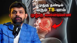 Can TB in the Spine Cause a Curve in Your Back? Dr. Vignesh Pushparaj