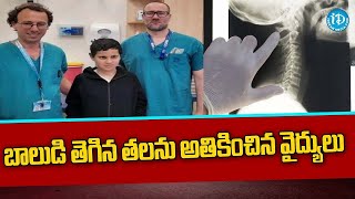 బాలుడి తెగిన తలను అతికించిన వైద్యులు | Israel Doctors Reattach Boy's Head || iDream