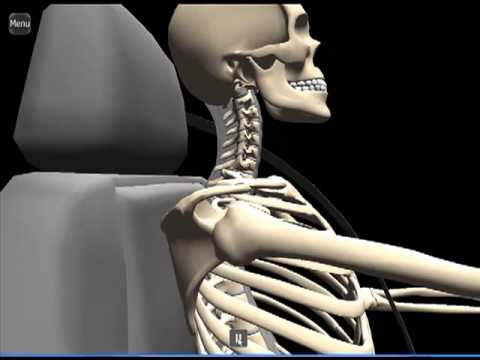 Whiplash Animation - YouTube