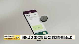 Scott Checks Up On Chart Of Dexcom (DXCM)