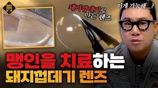 돼지껍데기 렌즈를 이식했더니 시력을 완전히 회복한 시각 장애인들??? [차트를 달리는 남자] | KBS Joy 221126 방송