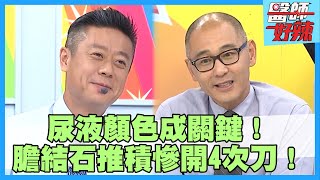 孕婦尿液變「這顏色」！檢查驚見竟百顆膽結石藏體內！【#醫師好辣】江坤俊 蘿莉塔 劉懿珊 主題特映版