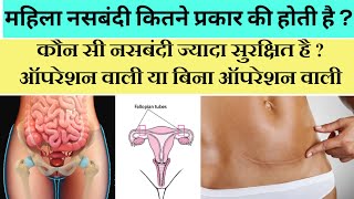 महिला नसबंदी कितने प्रकार की होती है ? Types of female sterilization