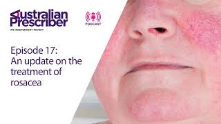 Episode 17 – An update on the treatment of rosacea