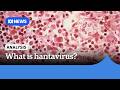 Hantavirus Explained | ABC NEWS
