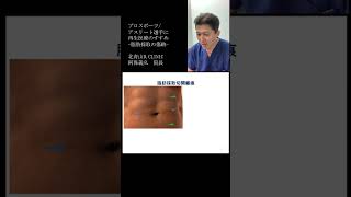 ＜再生医療＞「プロスポーツ選手の方々へ再生医療のすすめ」より⑰脂肪採取の傷跡　YouTubeショート #shorts #幹細胞　#msc #エクソソーム #間葉系幹細胞　#prp