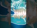 impacted wisdom teeth 😮 explained explained usa viral