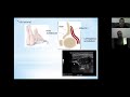 developmental dysplasia of the hip ddh frcs exam review. orthopaedic academy