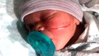 Newborn Gets Gash on Face From C-Section Scalpel