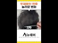 남자 정수리 두피문신 전후 안전하고 확실한 효과ㅣ뉴헤어 두피문신 shorts shortsvideo