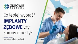 Co lepiej wybrać - implanty zębowe czy korony i mosty? - Zdrowie Szczecin